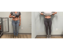 glp-1 before and after  