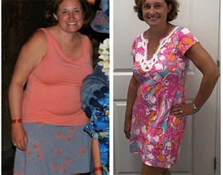 Charleston Patient Loses 25 lbs, 15 inches in 6 Months!