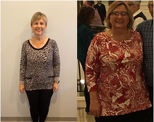 Summerville Patient Loses 55 Pounds