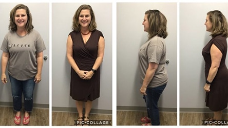 Rock Hill Patient Loses 29 lbs