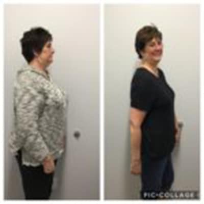 Three patients, three customized plans, 133 pounds lost!