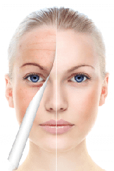 Make A Plan to Repair Skin Damage with NEW Microneedling Treatment
