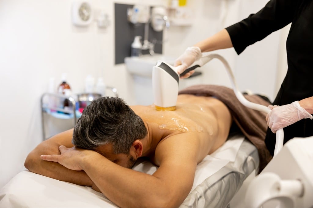 Tips to Prepare Yourself for Laser Hair Removal